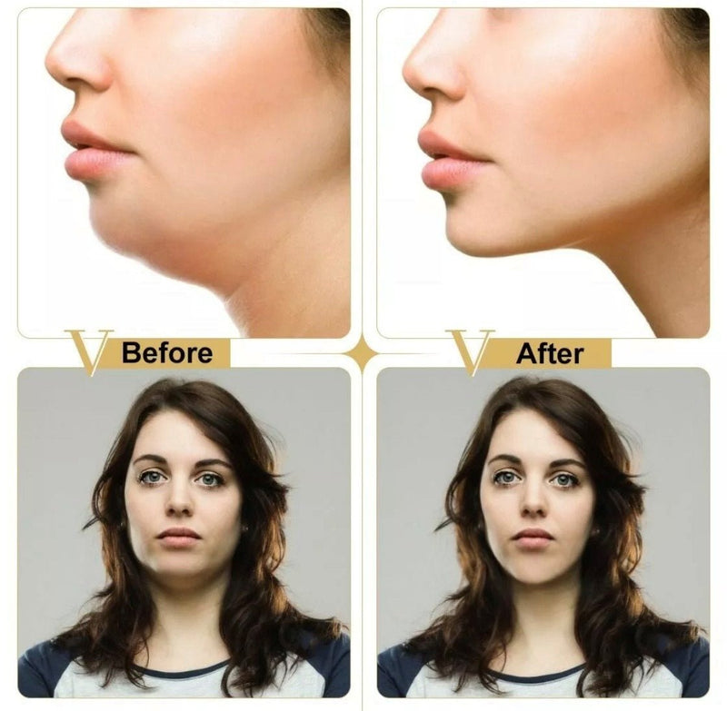 V Line Face Lifting Mask Double Chin Reducer V Shape Slimming Firming Mask Slim - Calmshops.co.uk